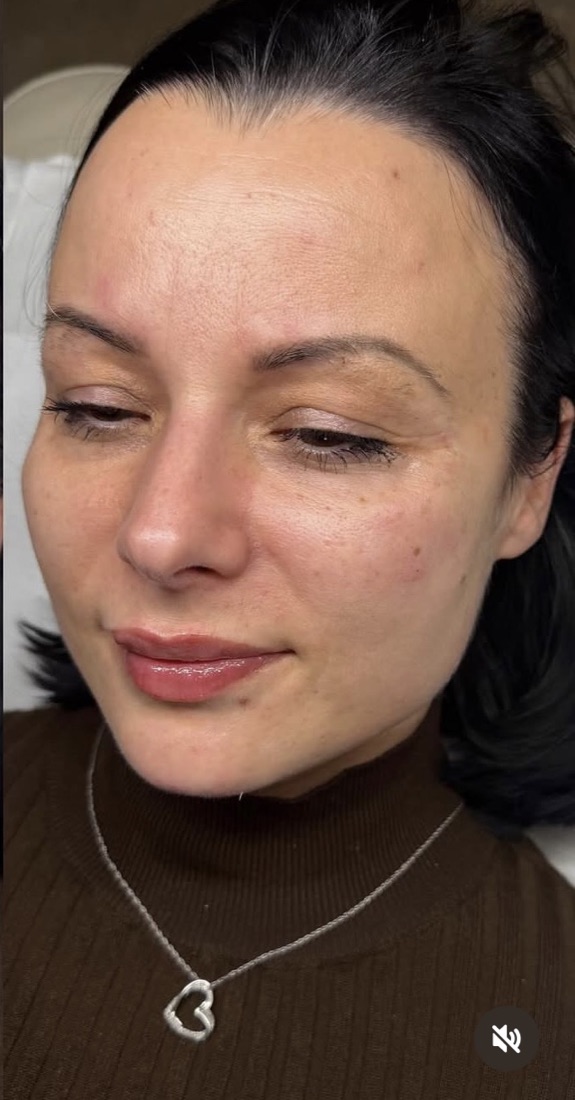 Brows before — sparse and uneven