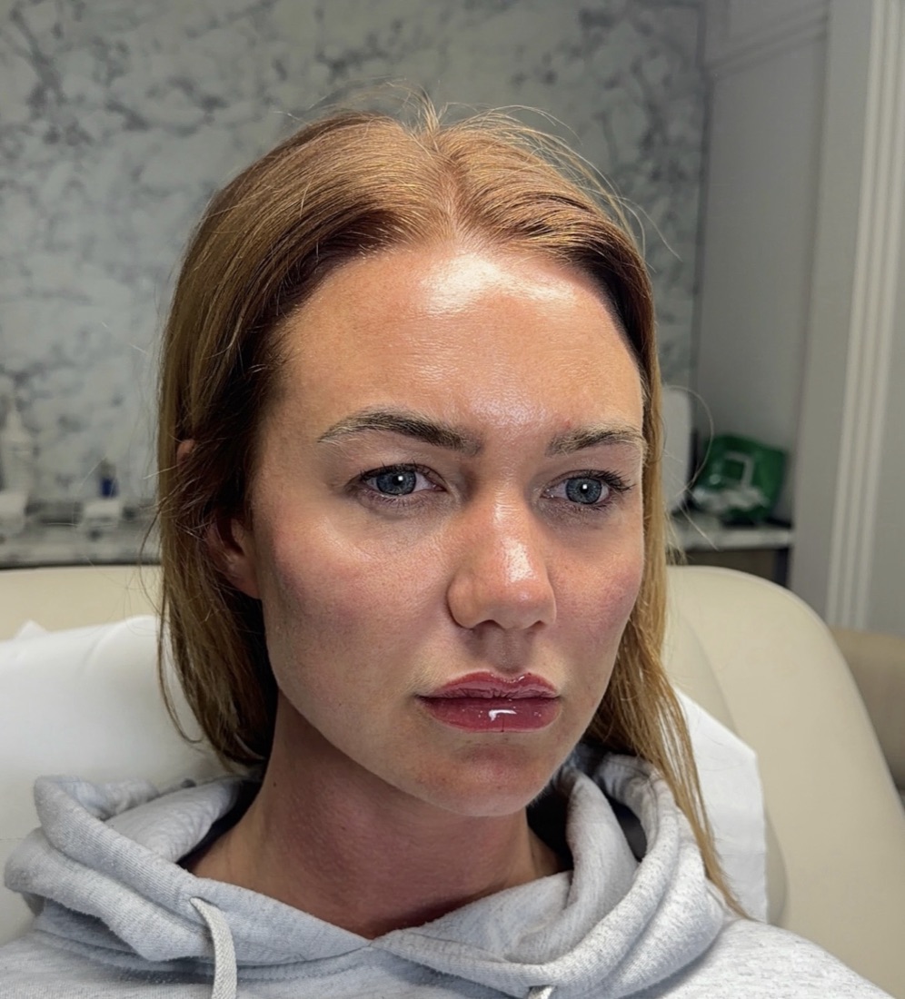 Skin after — calmer, brighter, more even
